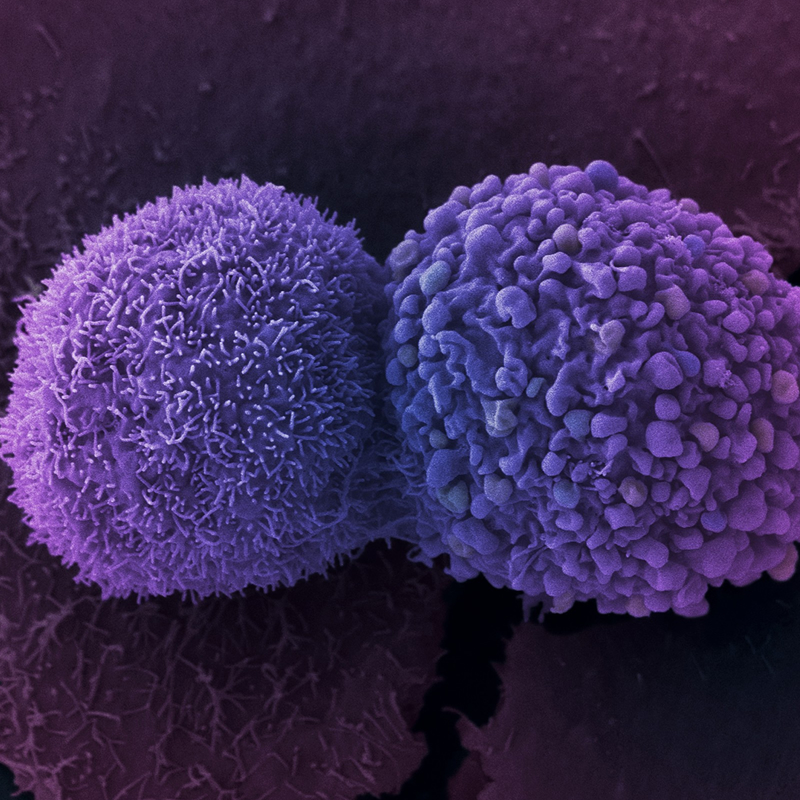 Una herramienta para descifrar el genoma de los tumores y optimizar los tratamientos.